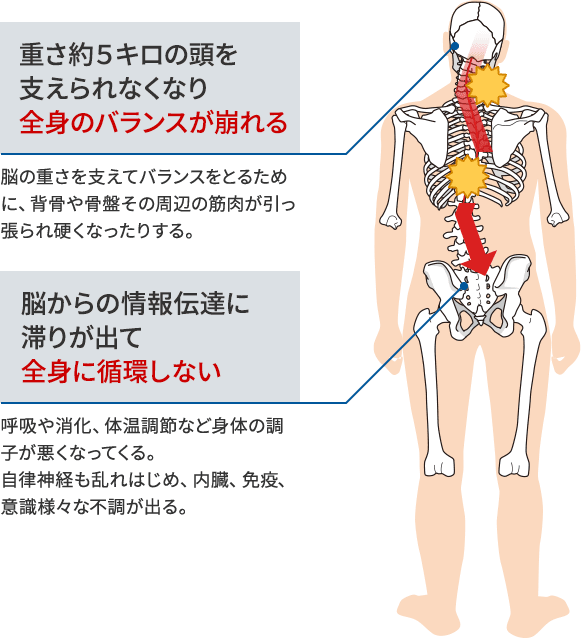 「重さ約5キロの頭を支えられなくなり全身のバランスが崩れる」「脳からの情報伝達に滞りが出て全身に循環しない」